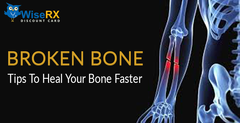 Broken bone tips