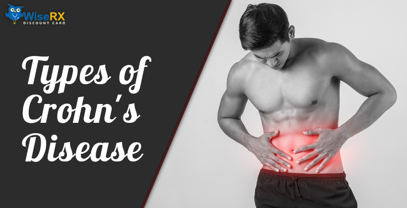 Types-of-Crohns-Disease