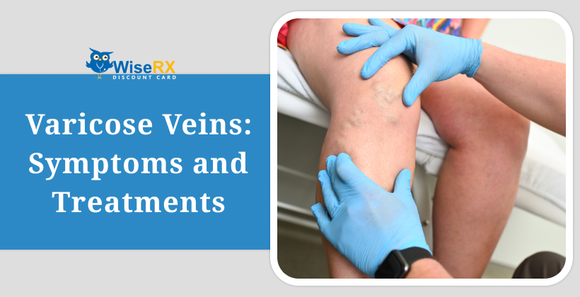 How to Prevent Varicose Veins? - WiseRxcard