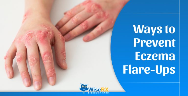 Ways to Prevent Eczema Flare-Ups